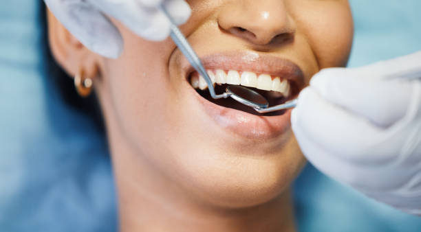 Best Urgent Care for Lost Fillings or Crowns in Dadeville, AL